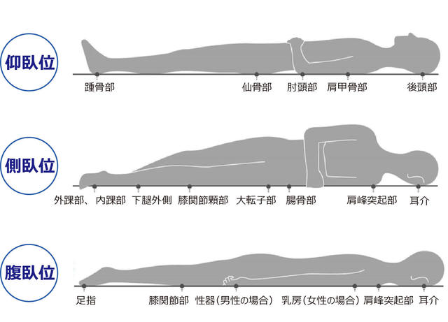 図：褥瘡のできやすい部位を表す図。寝方により褥瘡のできやすい部位を示す。仰臥位は後頭部・肩甲骨部・肘頭部・仙骨部・踵骨部に、側臥位は耳介・肩峰突起部・腸骨部・大転子部・膝関節頭部・下脛外側・内踝部・外踝部に、腹臥位は耳介・肩峰突起部・乳房（女性）・性器（男性）・膝関節部・足指にできやすくなる。