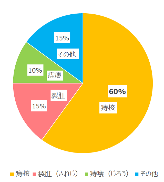 図1：肛門疾患に占める「痔」の割合を示す円グラフ。60%が痔核を締めることを示す。