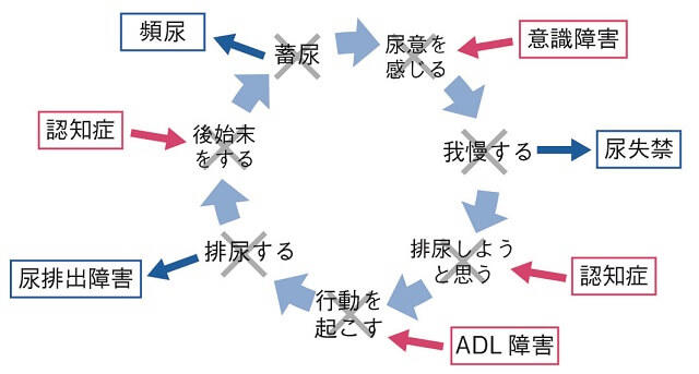 図2：排尿サークルによる排尿行為ができなくなると起こる排尿障害を表す図。