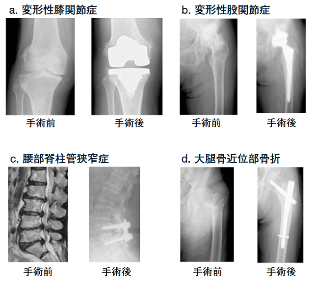 図3：膝関節、股関節、腰などの各運動器疾患の状態を表す図