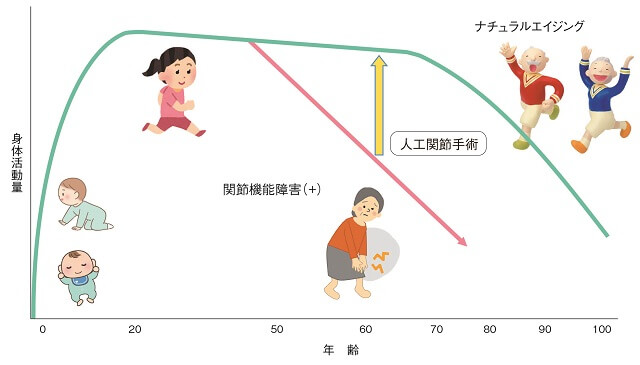 図7：年齢と身体活動の関係と変形性関節症による関節の機能障害により身体活動が低下することに対し、人工関節手術の意義を示す図。